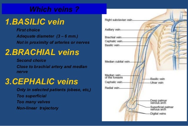 TARTING YOUR VENOUS ACCESS PROGRAM