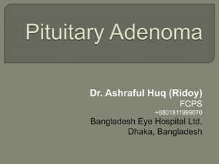 Dr. Ashraful Huq (Ridoy)
FCPS
+8801811999070
Bangladesh Eye Hospital Ltd.
Dhaka, Bangladesh
 