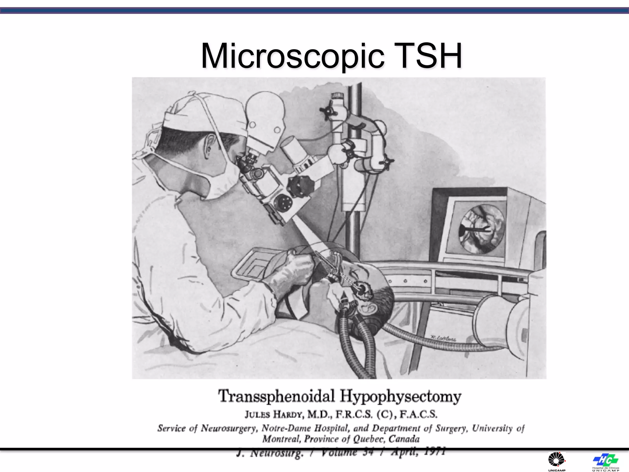 Microscopic TSH
 