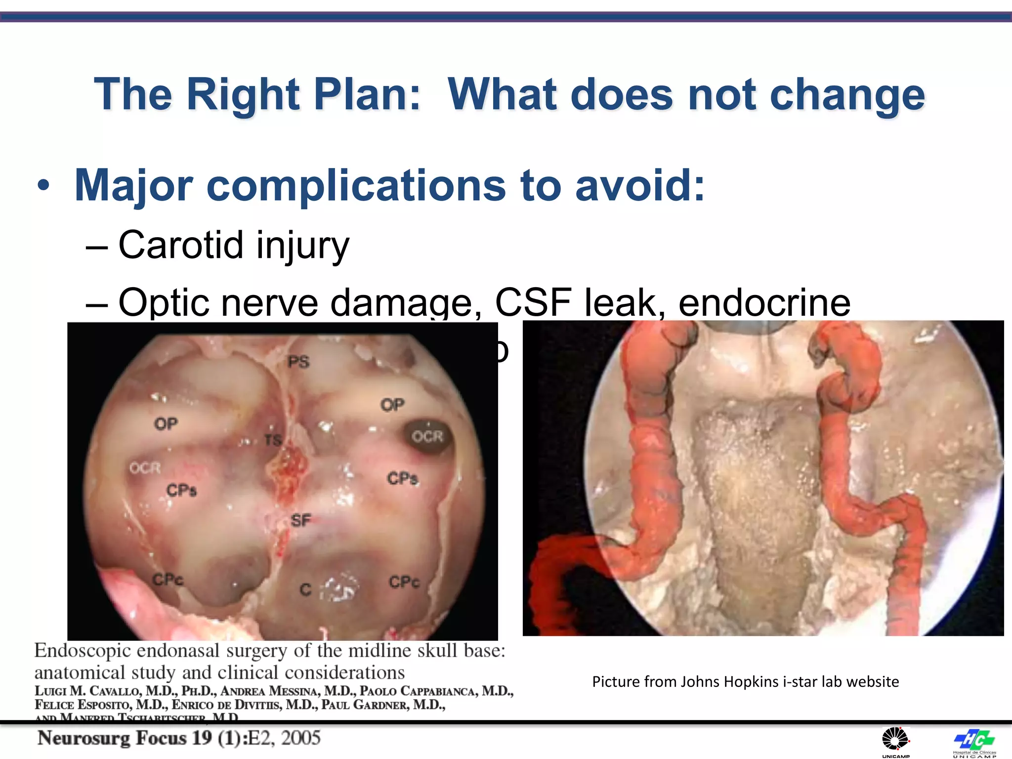 The Right Plan: What does not change
• Major complications to avoid:
– Carotid injury
– Optic nerve damage, CSF leak, endocrine
complications, post-op hemorrhage
Picture from Johns Hopkins i-star lab website
 