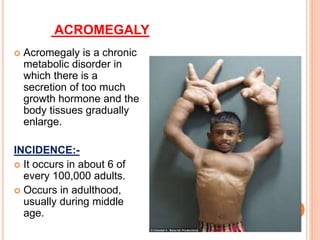 ACROMEGALY
 Acromegaly is a chronic
metabolic disorder in
which there is a
secretion of too much
growth hormone and the
body tissues gradually
enlarge.
INCIDENCE:-
 It occurs in about 6 of
every 100,000 adults.
 Occurs in adulthood,
usually during middle
age.
 