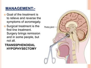 MANAGEMENT:-
 Goal of the treatment is
to relieve and reverse the
symptoms of acromegaly.
 Surgical treatment is the
first line treatment.
Surgery brings remission
and in some people, but
not all.
TRANSSPHENOIDAL
HYPOPHYSECTOMY
 