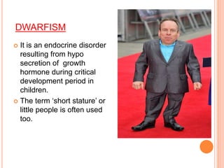 DWARFISM
 It is an endocrine disorder
resulting from hypo
secretion of growth
hormone during critical
development period in
children.
 The term ‘short stature’ or
little people is often used
too.
 