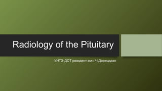 Radiology of the Pituitary
УНТЭ-ДОТ резидент эмч: Ч.Доржцэдэн
 