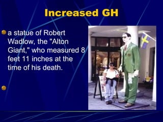 Increased GH
a statue of Robert
Wadlow, the "Alton
Giant," who measured 8
feet 11 inches at the
time of his death.
 
