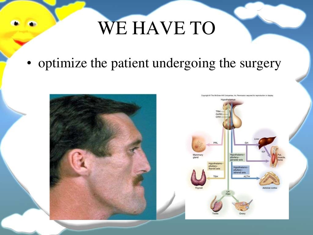 Pituitary gland disorders and anesthetic management