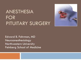 ANESTHESIA  
FOR  
PITUITARY SURGERY
Edward B. Fohrman, MD
Neuroanesthesiology
Northwestern University
Feinberg School of Medicine
 