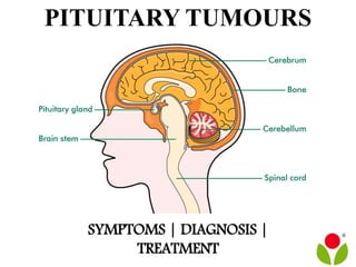 PITUITARY TUMOURS
SYMPTOMS | DIAGNOSIS |
TREATMENT
 