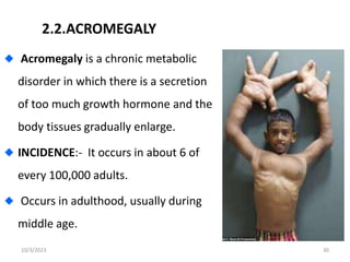 2.2.ACROMEGALY
Acromegaly is a chronic metabolic
disorder in which there is a secretion
of too much growth hormone and the
body tissues gradually enlarge.
INCIDENCE:- It occurs in about 6 of
every 100,000 adults.
Occurs in adulthood, usually during
middle age.
10/3/2023 30
 