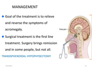 MANAGEMENT
Goal of the treatment is to relieve
and reverse the symptoms of
acromegaly.
Surgical treatment is the first line
treatment. Surgery brings remission
and in some people, but not all.
TRANSSPHENOIDAL HYPOPHYSECTOMY
10/3/2023 35
 