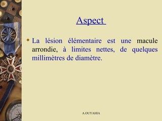Aspect  La lésion élémentaire est une  macule arrondie ,  à limites nettes, de quelques millimètres de diamètre.   