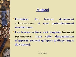 Aspect Évolution: les lésions deviennent  achromatiques  et sont particulièrement inesthétiques.   Les lésions actives sont toujours  finement squameuses , mais cette desquamation n’apparaît souvent qu’après grattage (signe du copeau).   