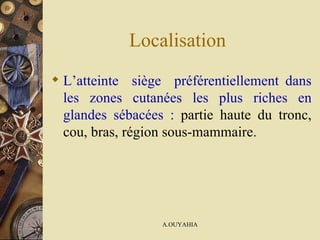 Localisation  L’atteinte  siège  préférentiellement dans les zones cutanées les plus riches en glandes sébacées :  partie haute du tronc, cou, bras, région sous-mammaire . 