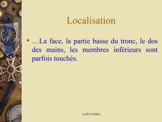 Localisation … La face, la partie basse du tronc, le dos des mains, les membres inférieurs sont parfois touchés.  