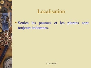 Localisation Seules les paumes et les plantes sont toujours indemnes.  