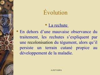 Évolution  La rechute  En dehors d’une mauvaise observance du traitement, les rechutes s’expliquent par une   recolonisation  du tégument, alors qu’il persiste un terrain cutané propice au développement de la maladie.   