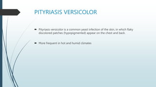 PITYRIASIS VERSICOLOR
 Pityriasis versicolor is a common yeast infection of the skin, in which flaky
discolored patches (hypopigmented) appear on the chest and back.
 More frequent in hot and humid climates
 