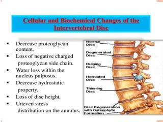 prolapsed intervertebral disc presentation | PPTX