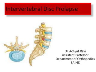 Intervertebral Disc Prolapse
Dr. Achyut Ravi
Assistant Professor
Department of Orthopedics
SAIMS
 