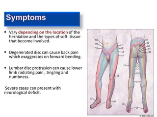  symptoms of a herniated disc can
 Vary depending on the location of the
herniation and the types of soft tissue
that become involved.
 Degenerated disc can cause back pain
which exaggerates on forward bending.
 Lumbar disc protrusion can cause lower
limb radiating pain , tingling and
numbness.
Severe cases can present with
neurological deficit.
 