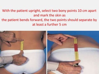 With the patient upright, select two bony points 10 cm apart
and mark the skin as
the patient bends forward, the two points should separate by
at least a further 5 cm
 