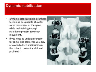 Dynamic stabilization
• Dynamic stabilization is a surgical
technique designed to allow for
some movement of the spine,
while maintaining enough
stability to prevent too much
movement.
• If you need to undergo surgery
for spinal disc problems, you may
also need added stabilization of
the spine to prevent additional
problems
 