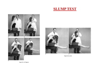 Slump Test Disc INTERVERTEBRAL DISC ANATOMY AND PIVD OF LUMBAR SPINE AND ITS MANAGEMENT ...