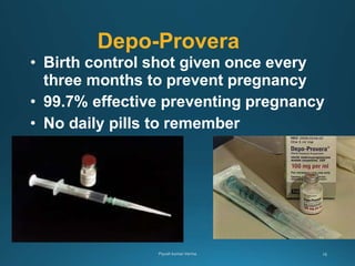 Depo-Provera
• Birth control shot given once every
three months to prevent pregnancy
• 99.7% effective preventing pregnancy
• No daily pills to remember
 