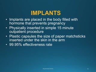 IMPLANTS
• Implants are placed in the body filled with
hormone that prevents pregnancy
• Physically inserted in simple 15 minute
outpatient procedure
• Plastic capsules the size of paper matchsticks
inserted under the skin in the arm
• 99.95% effectiveness rate
 