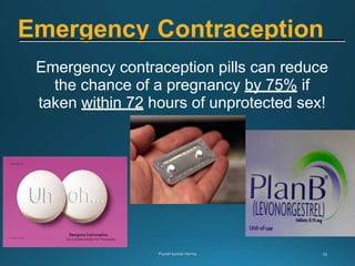 Emergency contraception pills can reduce
the chance of a pregnancy by 75% if
taken within 72 hours of unprotected sex!
Emergency Contraception
 