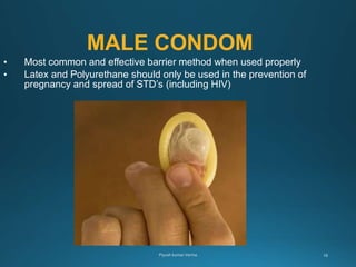MALE CONDOM
• Most common and effective barrier method when used properly
• Latex and Polyurethane should only be used in the prevention of
pregnancy and spread of STD’s (including HIV)
 
