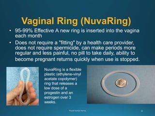 Vaginal Ring (NuvaRing)
• 95-99% Effective A new ring is inserted into the vagina
each month
• Does not require a "fitting" by a health care provider,
does not require spermicide, can make periods more
regular and less painful, no pill to take daily, ability to
become pregnant returns quickly when use is stopped.
NuvaRing is a flexible
plastic (ethylene-vinyl
acetate copolymer)
ring that releases a
low dose of a
progestin and an
estrogen over 3
weeks.
 