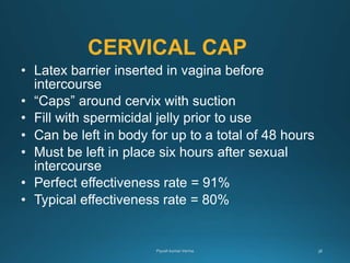 CERVICAL CAP
• Latex barrier inserted in vagina before
intercourse
• “Caps” around cervix with suction
• Fill with spermicidal jelly prior to use
• Can be left in body for up to a total of 48 hours
• Must be left in place six hours after sexual
intercourse
• Perfect effectiveness rate = 91%
• Typical effectiveness rate = 80%
 