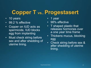 Copper T vs.. Progestasert
• 10 years
• 99.2 % effective
• Copper on IUD acts as
spermicide, IUD blocks
egg from implanting
• Must check string before
sex and after shedding of
uterine lining.
• 1 year
• 98% effective
• T shaped plastic that
releases hormones over
a one year time frame
• Thickens mucus, blocking
egg
• Check string before sex &
after shedding of uterine
lining.
 