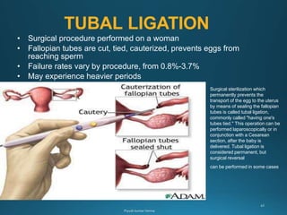 TUBAL LIGATION
• Surgical procedure performed on a woman
• Fallopian tubes are cut, tied, cauterized, prevents eggs from
reaching sperm
• Failure rates vary by procedure, from 0.8%-3.7%
• May experience heavier periods
Surgical sterilization which
permanently prevents the
transport of the egg to the uterus
by means of sealing the fallopian
tubes is called tubal ligation,
commonly called "having one's
tubes tied." This operation can be
performed laparoscopically or in
conjunction with a Cesarean
section, after the baby is
delivered. Tubal ligation is
considered permanent, but
surgical reversal
can be performed in some cases
 