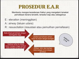 E : elevation (meninggikan)
A : airway (laluan udara)
R : resuscitation (resustasi atau pemulihan pernafasan)
Membantu mangsa kecederaan fraktur yang mengalami tersekat
pernafasan kerana tercekik, tersedut wap atau sebagainya
Buka laluan pernafasan dengan
meninggikan dagu
Lakukan pernafasan antara
mulut ke mulut dengan berlapik
Hembus nafas ke dalam
mulut mangsa hingga melihat
dada mangsa bergerak naik Alihkan bibir dan biarkan
dada mangsa turun dengan
perlahan
 