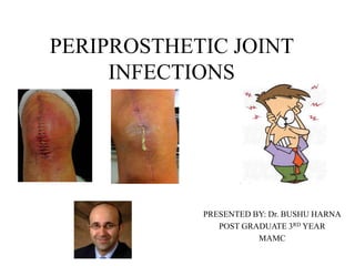 PERIPROSTHETIC JOINT
INFECTIONS
PRESENTED BY: Dr. BUSHU HARNA
POST GRADUATE 3RD YEAR
MAMC
 