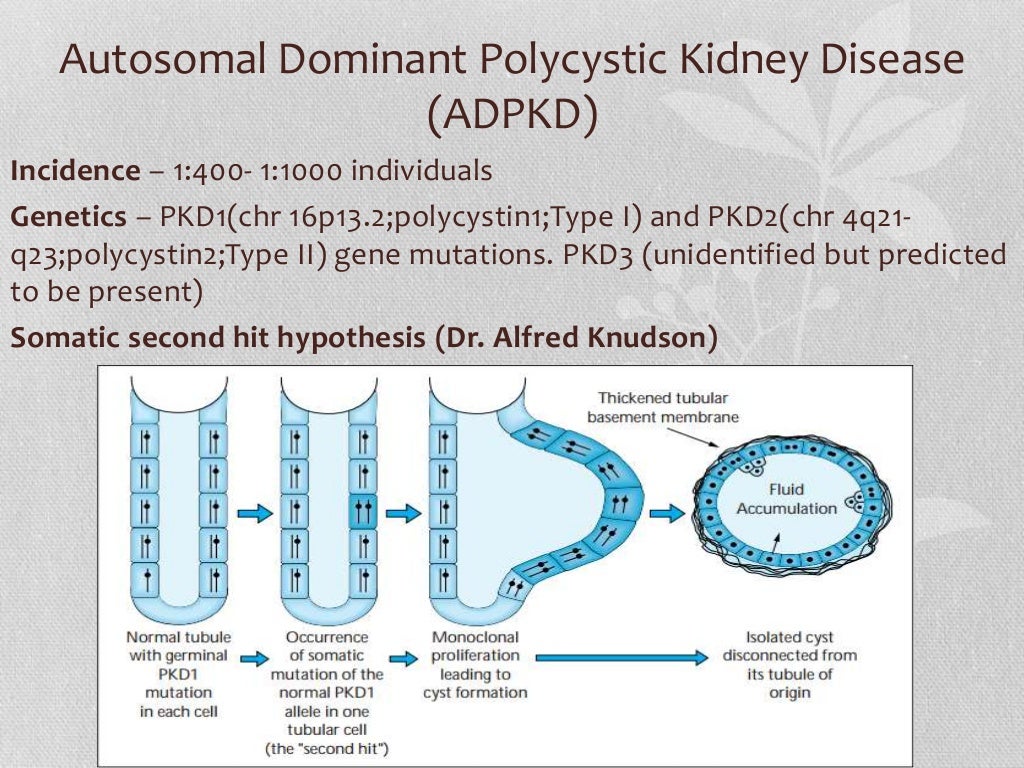 Polycystic Kidney Disease
