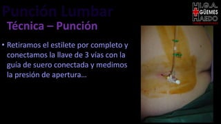 Punción Lumbar EMERGENTOLOGÍA
Técnica – Punción
• Retiramos el estilete por completo y
conectamos la llave de 3 vías con la
guía de suero conectada y medimos
la presión de apertura…
 