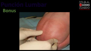 Punción Lumbar EMERGENTOLOGÍA
Bonus
 