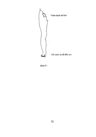 NGOẠI KHOA CƠ SỞ 