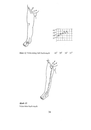 NGOẠI KHOA CƠ SỞ 