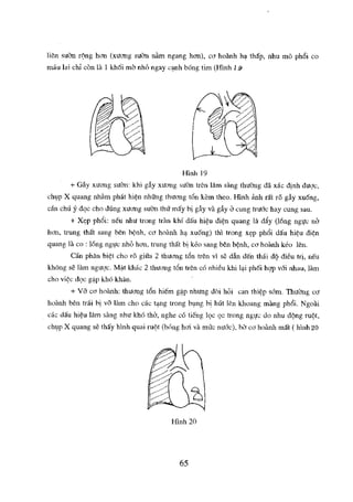 NGOẠI KHOA CƠ SỞ 