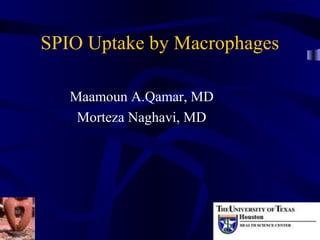 SPIO Uptake by Macrophages
Maamoun A.Qamar, MD
Morteza Naghavi, MD
 