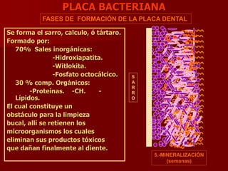 PLACA BACTERIANA
Se forma el sarro, calculo, ó tártaro.
Formado por:
70% Sales inorgánicas:
-Hidroxiapatita.
-Witlokita.
-Fosfato octocálcico.
30 % comp. Orgánicos:
-Proteínas. -CH. -
Lípidos.
El cual constituye un
obstáculo para la limpieza
bucal, allí se retienen los
microorganismos los cuales
eliminan sus productos tóxicos
que dañan finalmente al diente.
5.-MINERALIZACIÓN
(semanas)
FASES DE FORMACIÓN DE LA PLACA DENTAL
S
A
R
R
O
E
S
M
A
L
T
E
 