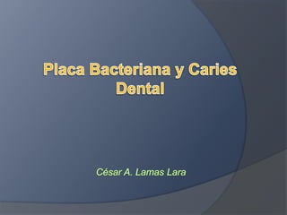 Placa Bacteriana y Caries Dental César A. Lamas Lara 