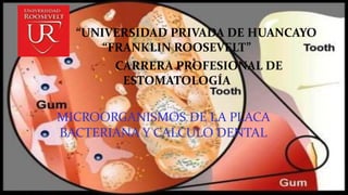 “UNIVERSIDAD PRIVADA DE HUANCAYO 
“FRANKLIN ROOSEVELT” 
CARRERA PROFESIONAL DE 
ESTOMATOLOGÍA 
MICROORGANISMOS DE LA PLACA 
BACTERIANA Y CALCULO DENTAL 
 