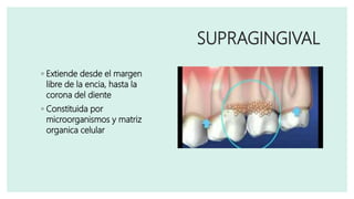 SUPRAGINGIVAL
◦ Extiende desde el margen
libre de la encia, hasta la
corona del diente
◦ Constituida por
microorganismos y matriz
organica celular
 