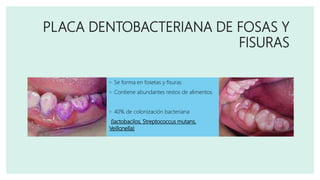 PLACA DENTOBACTERIANA DE FOSAS Y
FISURAS
◦ Se forma en fosetas y fisuras
◦ Contiene abundantes restos de alimentos
◦ 40% de colonización bacteriana
(lactobacilos, Streptococcus mutans,
Veillonella)
 