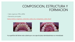 COMPOSICION, ESTRUCTURA Y
FORMACION
◦ Sales organicas (70% a 80%)
◦ Elementos principales
(calcio, fosforo, magnesio, carbonato, sodio, zinc, manganeso, cobre, fluor)
•La superficie del tártaro esta cubierta por una capa de placa dentobacteriana no mineralizada
 